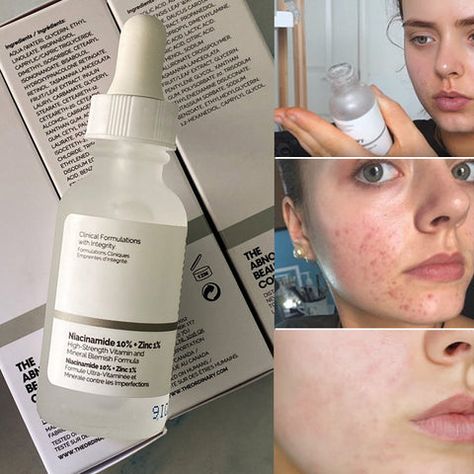 The Ordinary Niacinamide 10% + Zinc 1% 30ml Skincare Serum